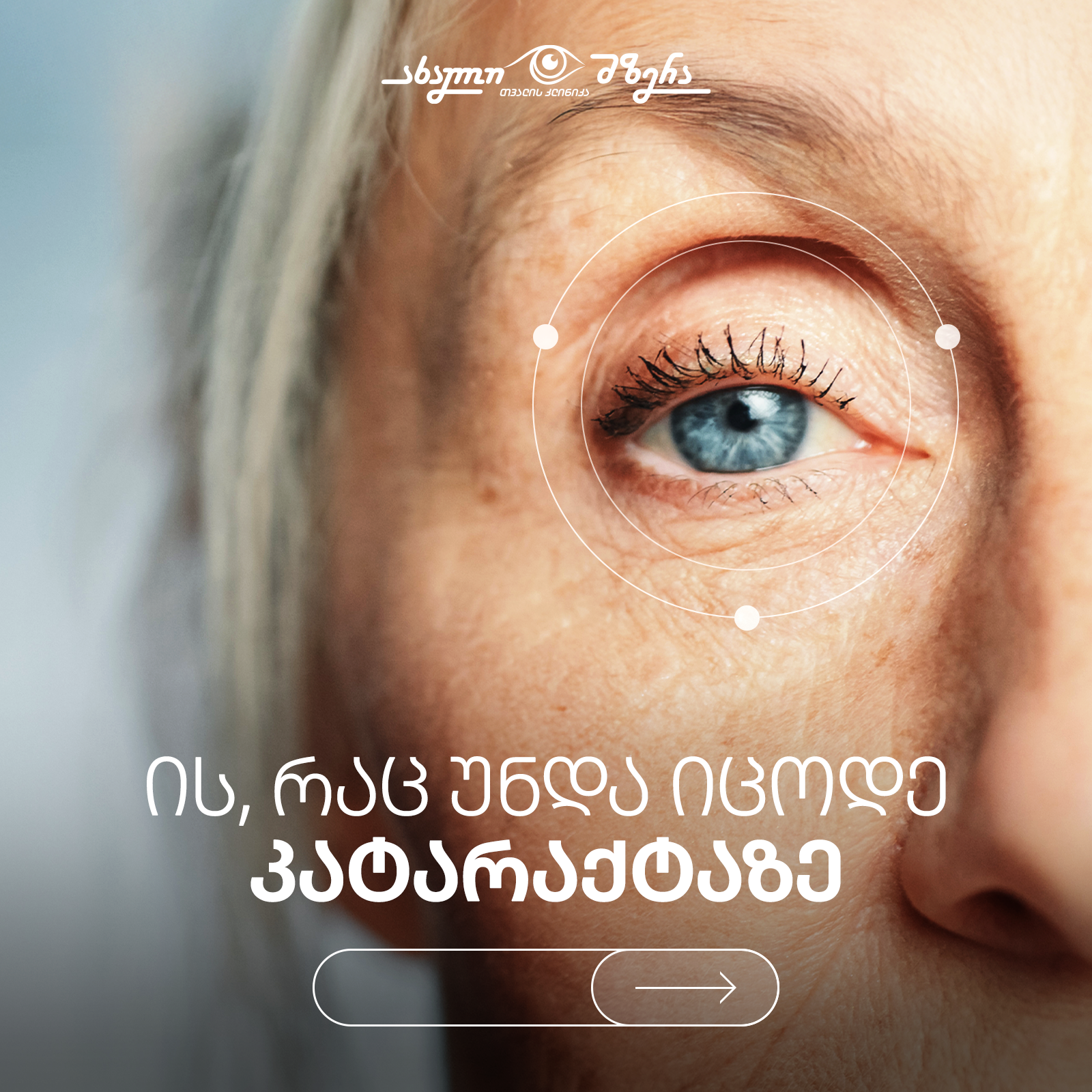 What You Need to Know About Cataract